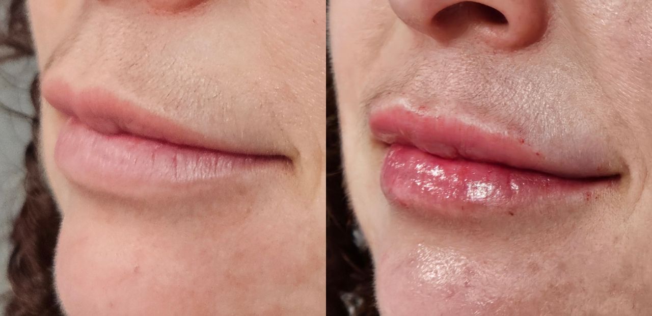 Rosalba Herrero Zerpa-563