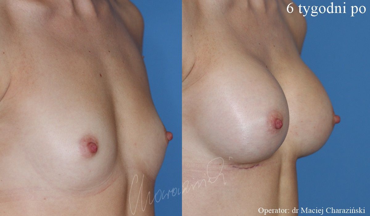 Maciej Charaziński-91