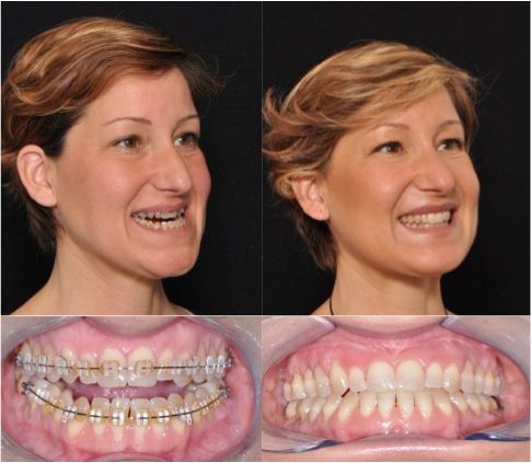 Alessandro Agrillo-6