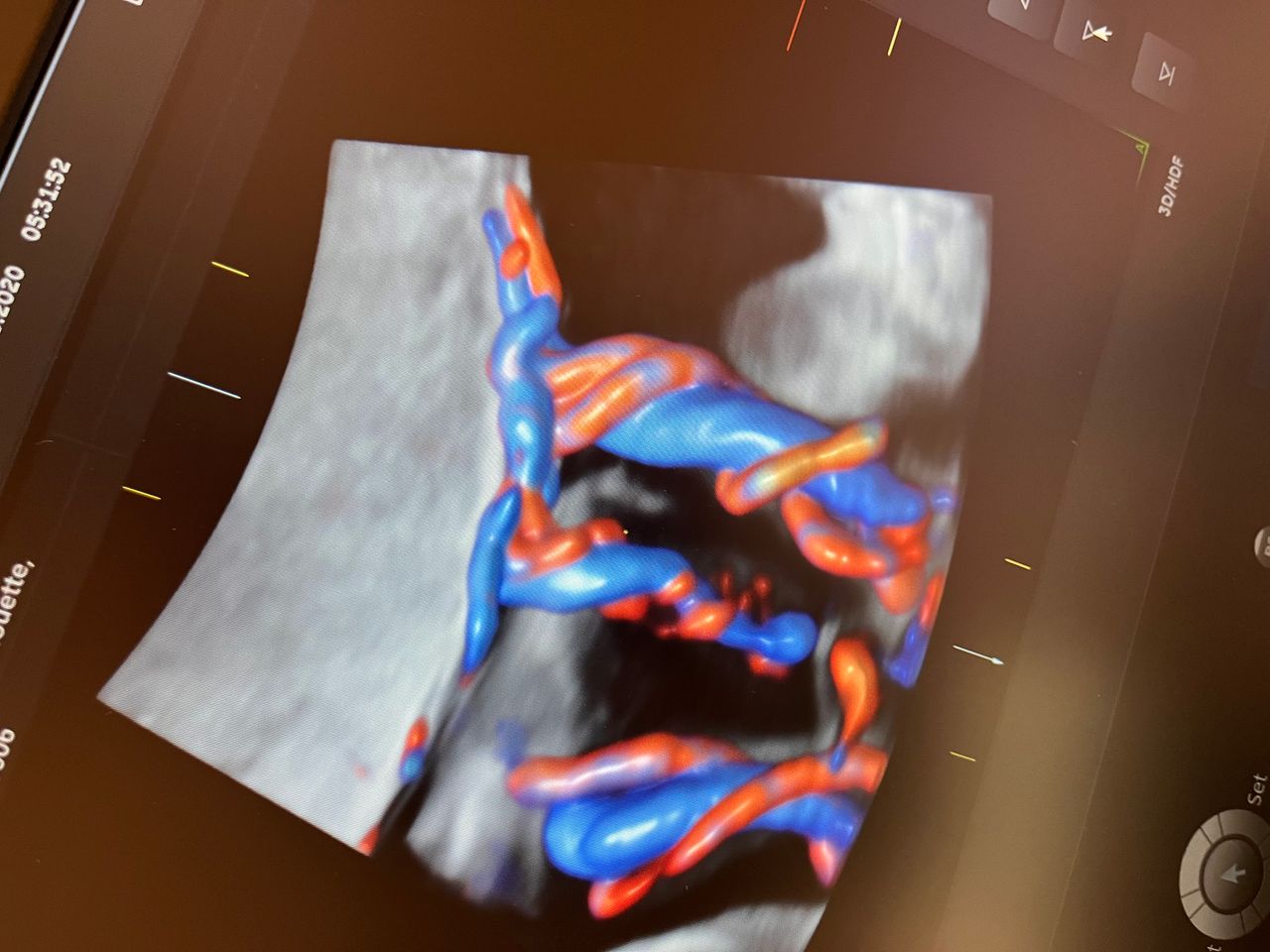 Katarzyna Leszczyńska-19