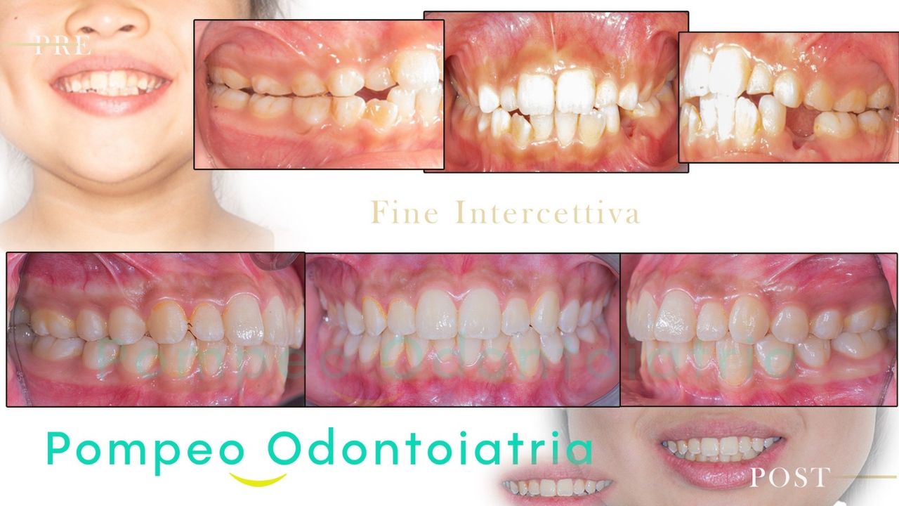 Enrico Maria Pompeo-5