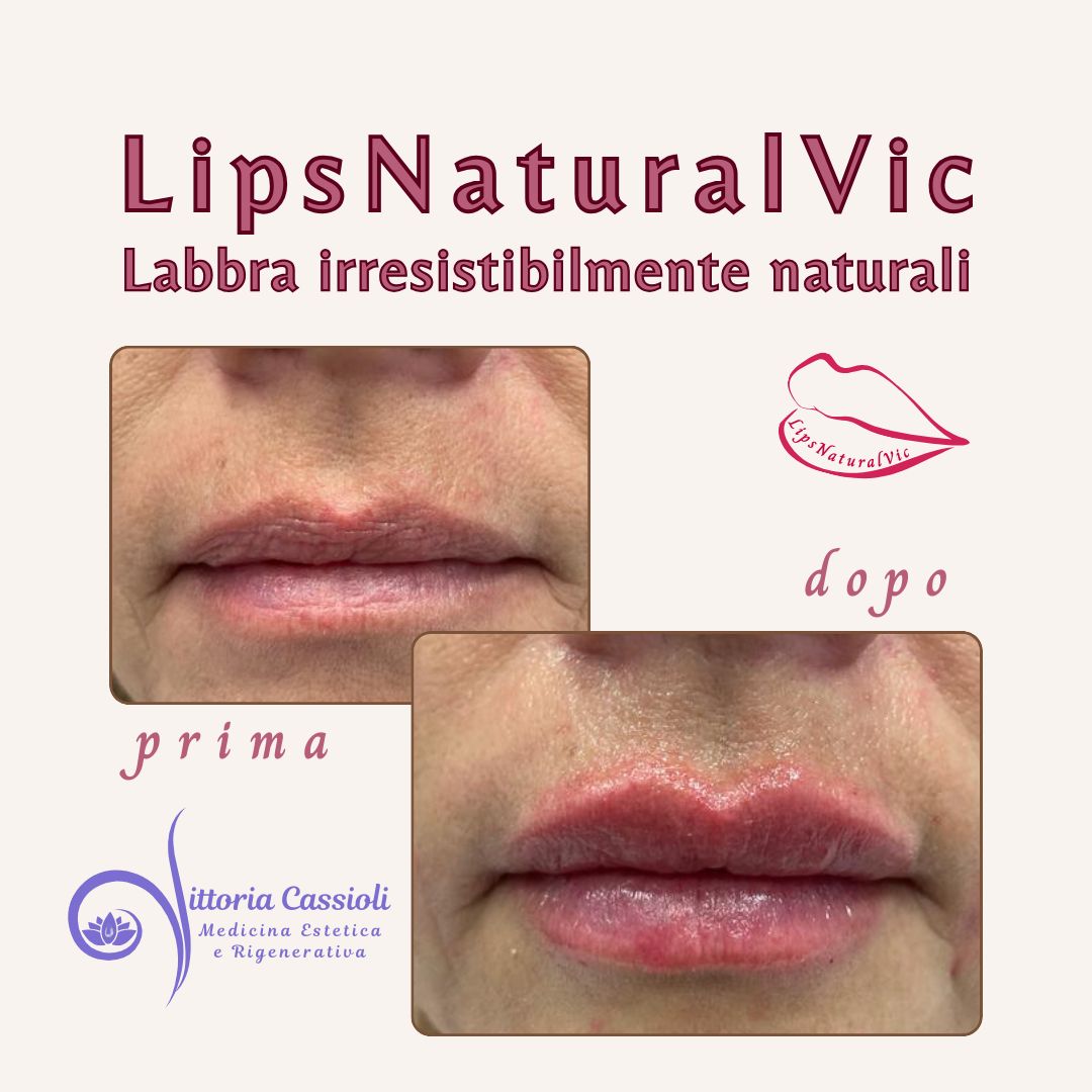 Vittoria Cassioli-41