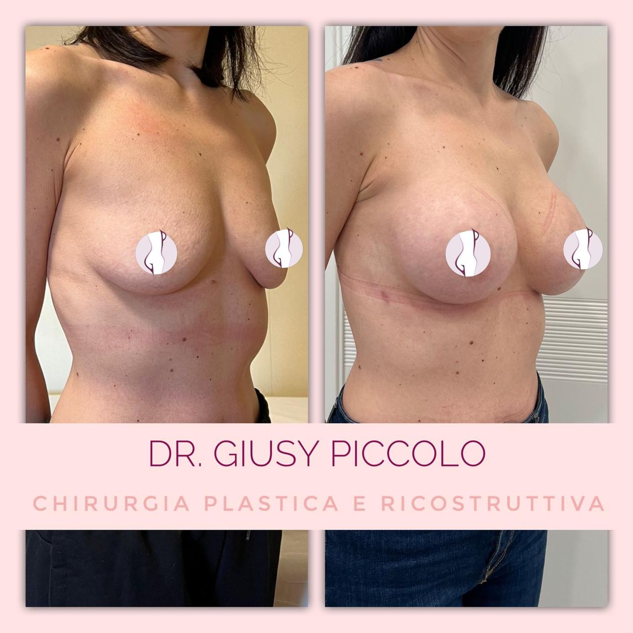 Giuseppina Piccolo-14