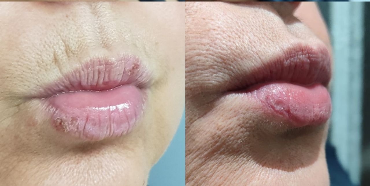 Rosalba Herrero Zerpa-62