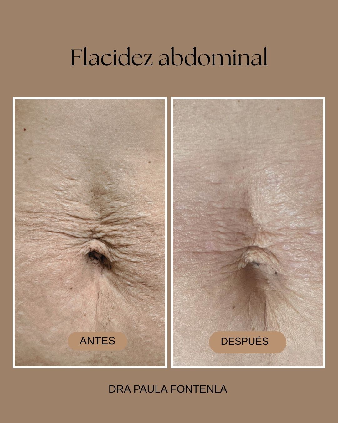 Paula Fontenla Seco-7