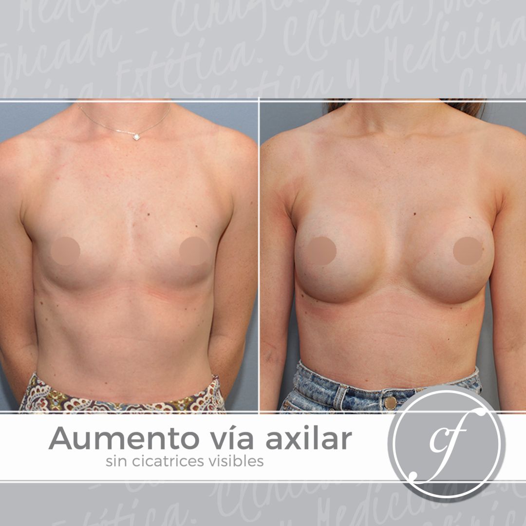 Eduardo Forcada Melero-5