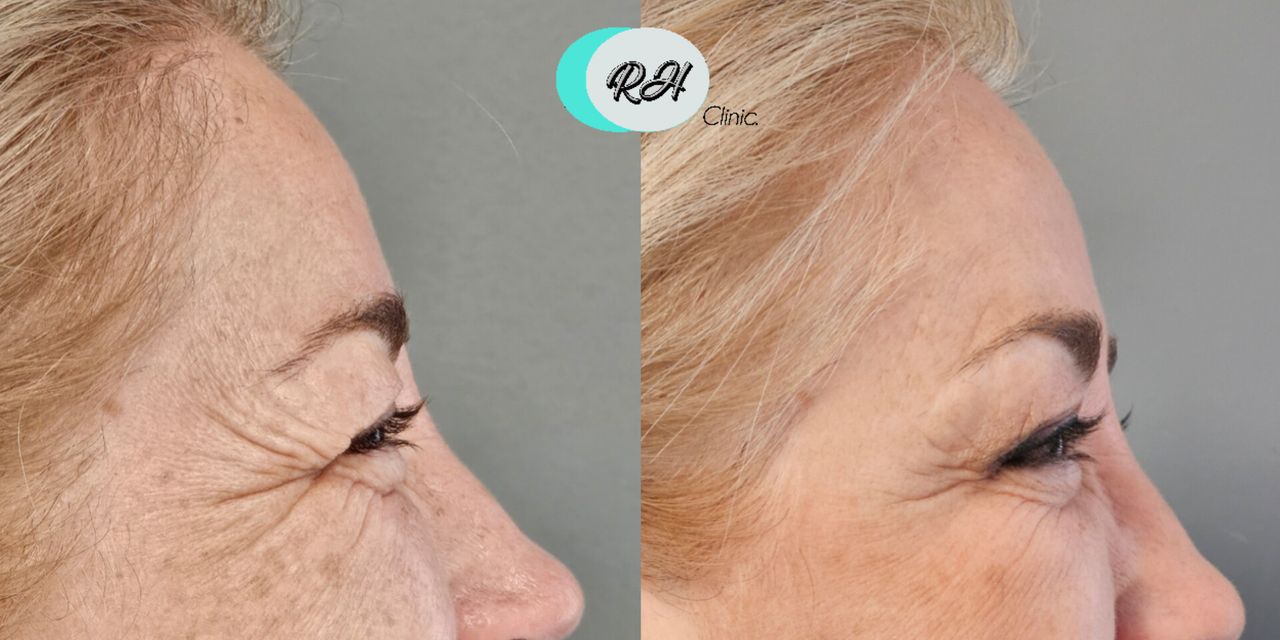 Rosalba Herrero Zerpa-602