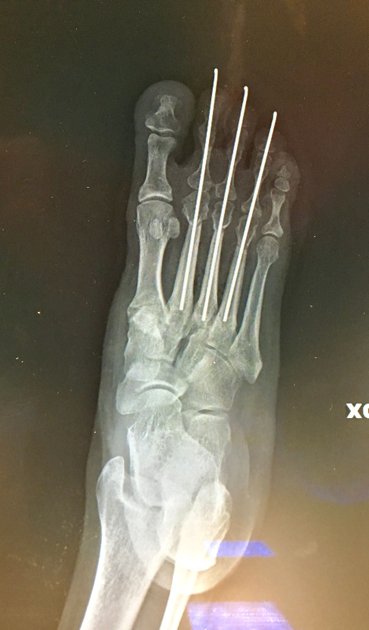 Alberto Maria Bonifazi-10