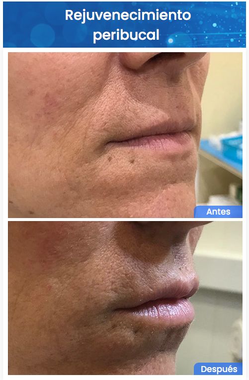 Juan Enrique Pérez Enríquez-132