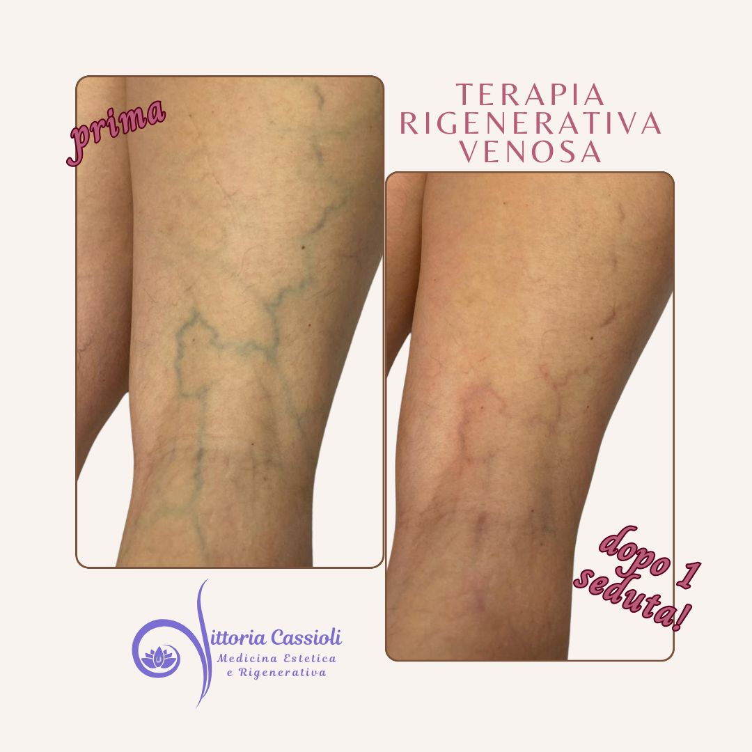 Vittoria Cassioli-47