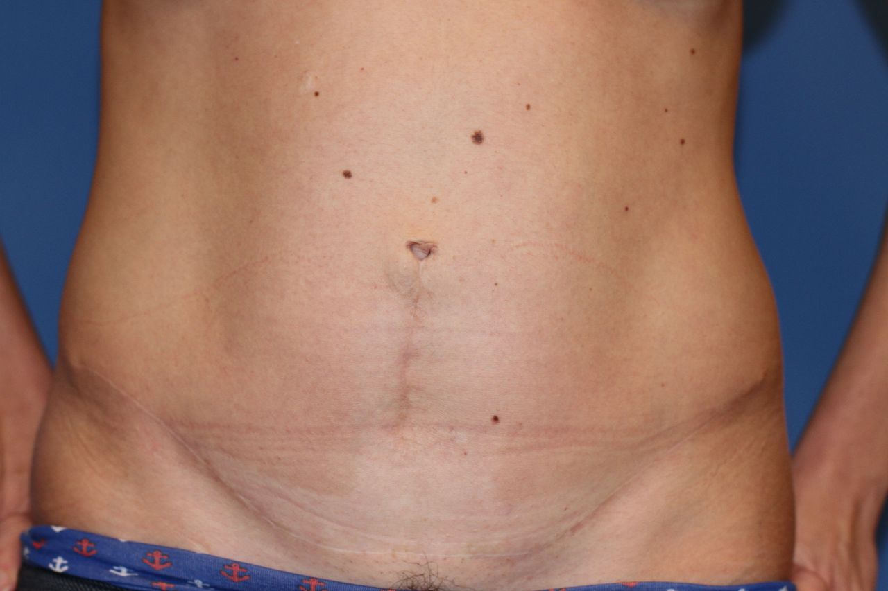 Maciej Charaziński-141