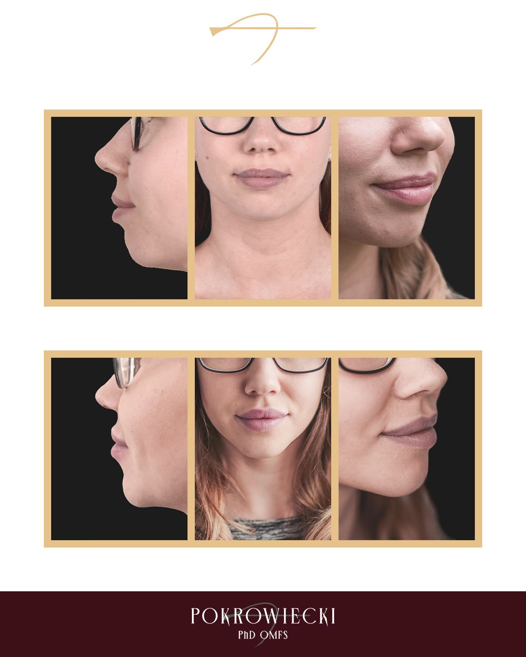 Rafał Pokrowiecki-16