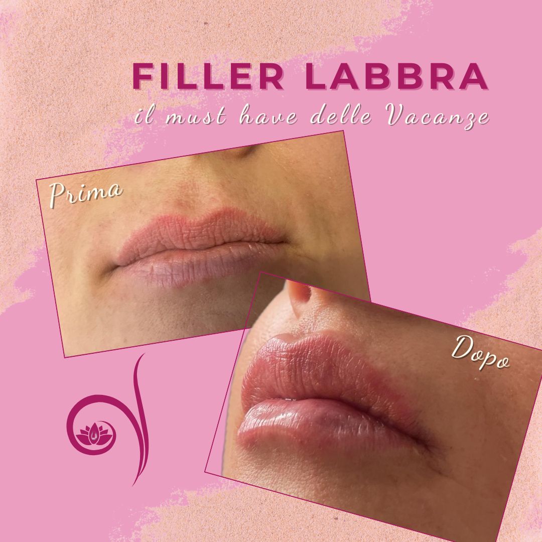 Vittoria Cassioli-13