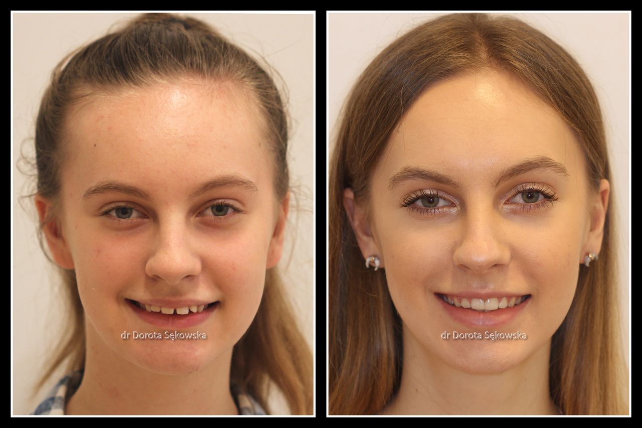 Dorota Sękowska-11