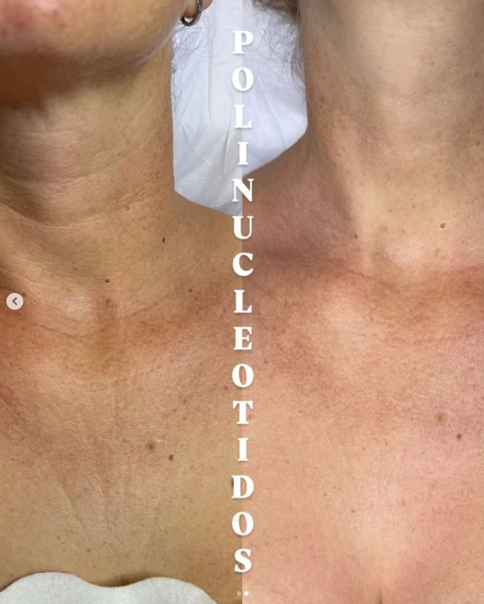 Nuris Dariela Valderrama Villanueva-5