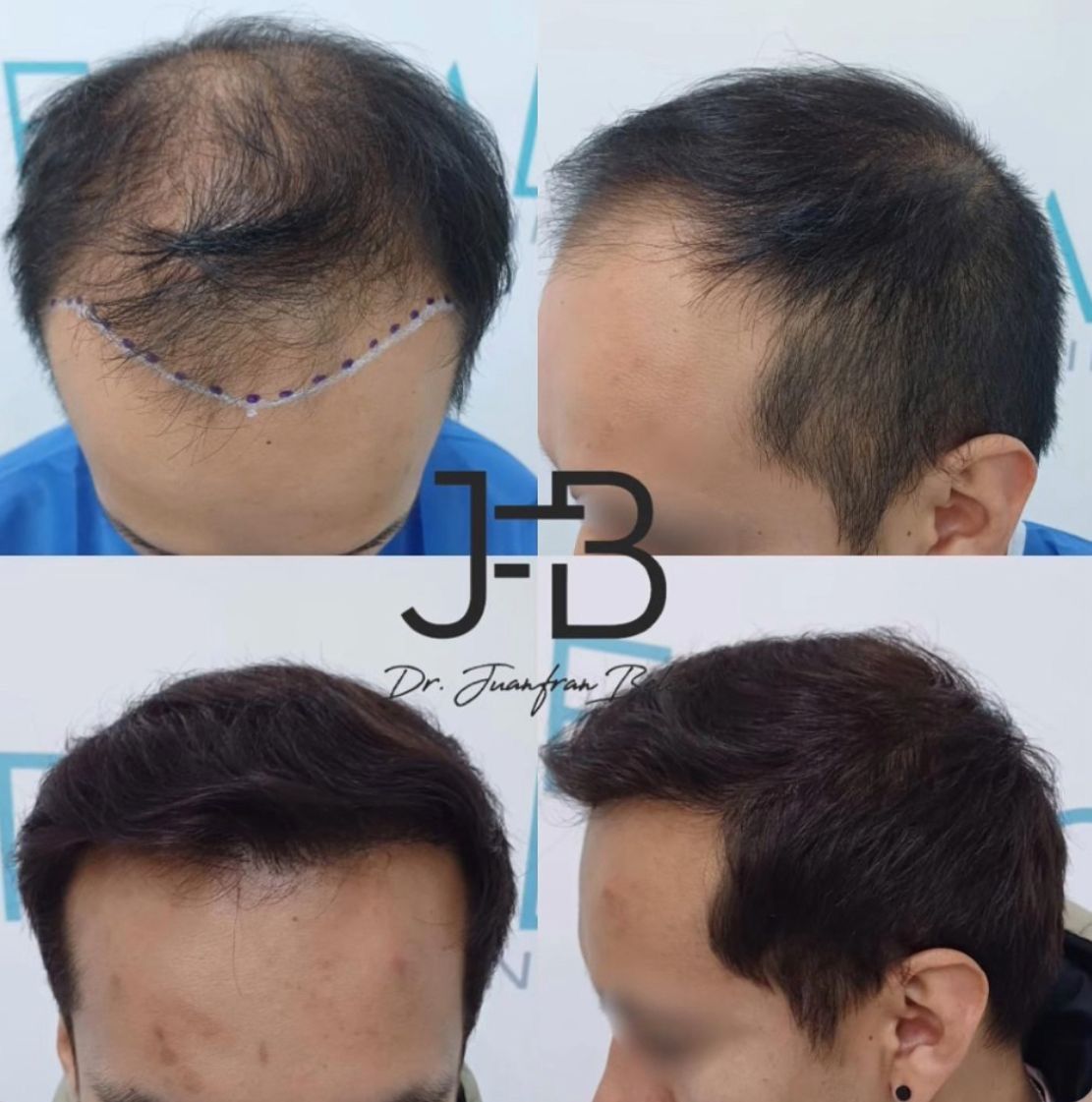 Juan Francisco Belén Montero-16