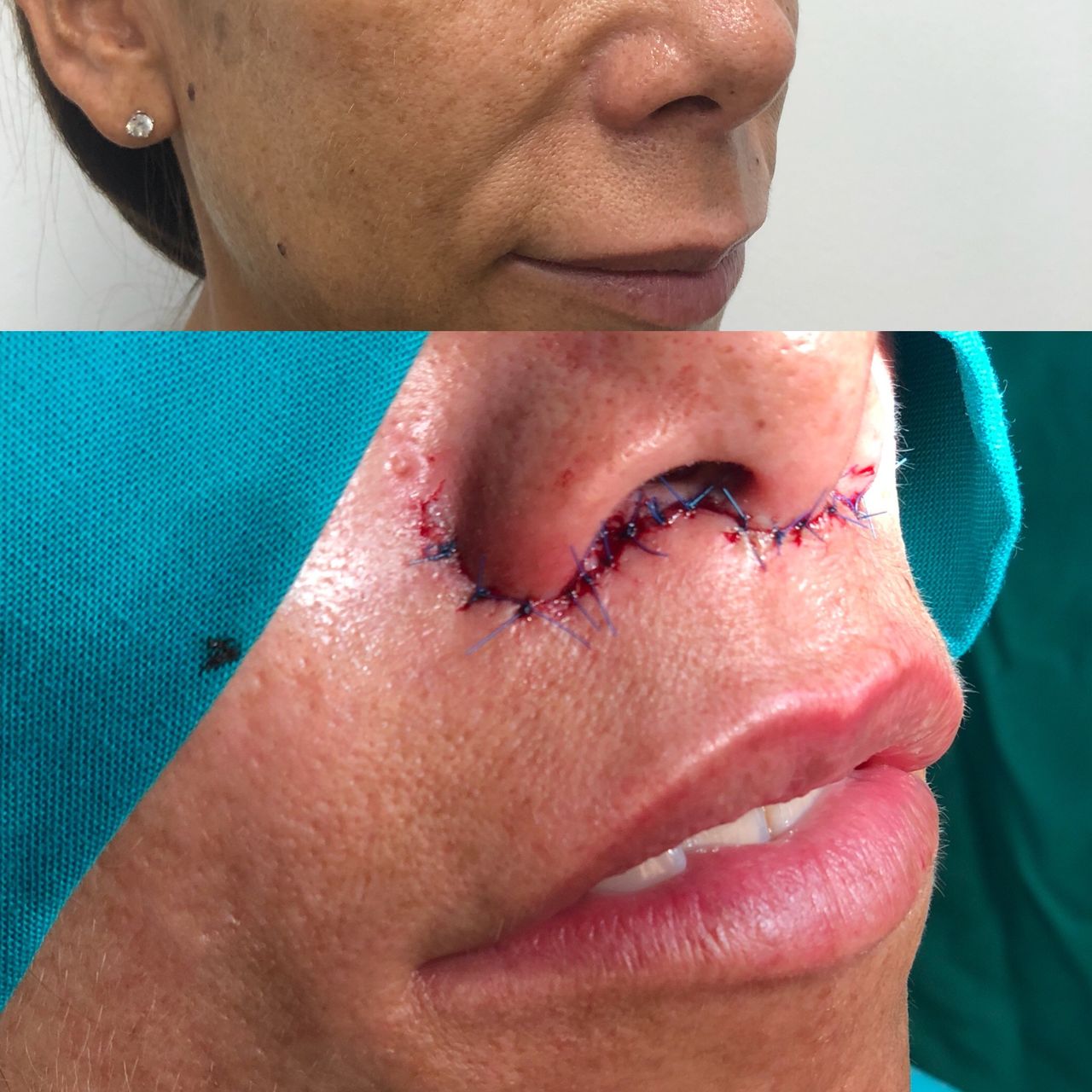 Alberto Candau Álvarez-33