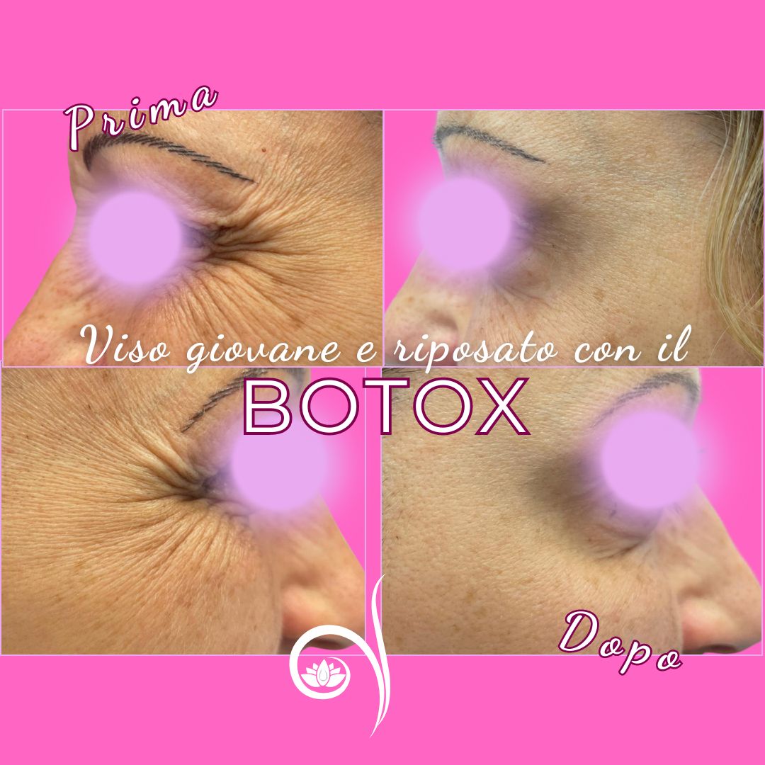 Vittoria Cassioli-15