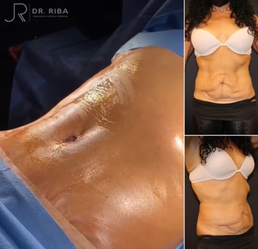 Jordi Riba Vilchez-70