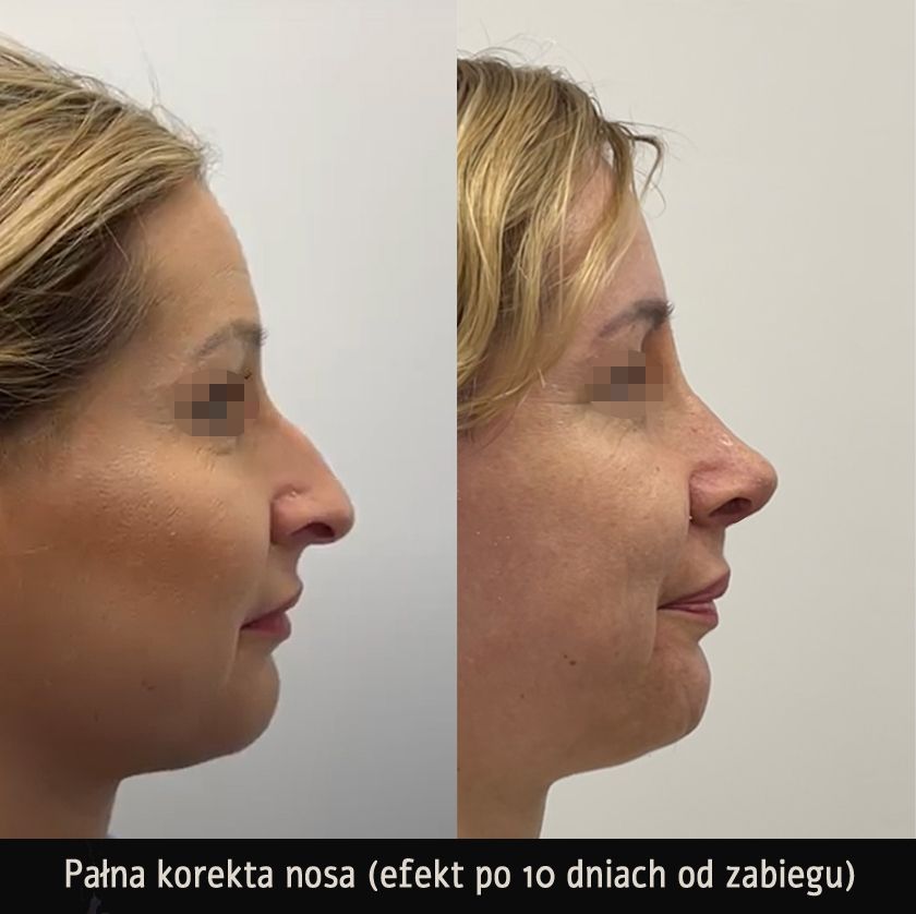 Mariusz Zagajewski-2