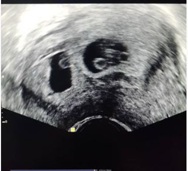 Hakan İbrahim Boyar-10