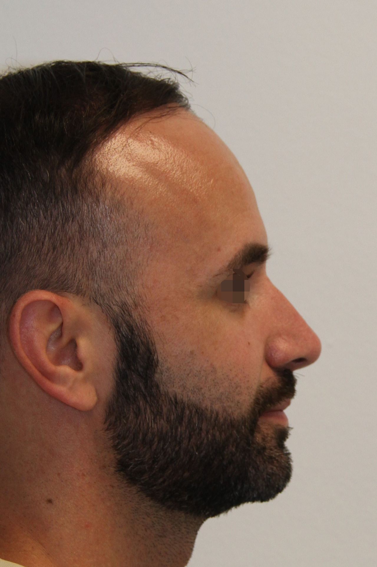 Xavier Barcelo Colomer-24