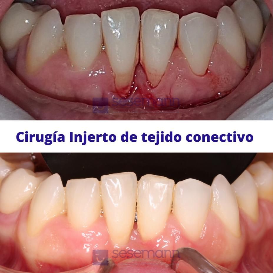 Paula Cano Carrillo-62