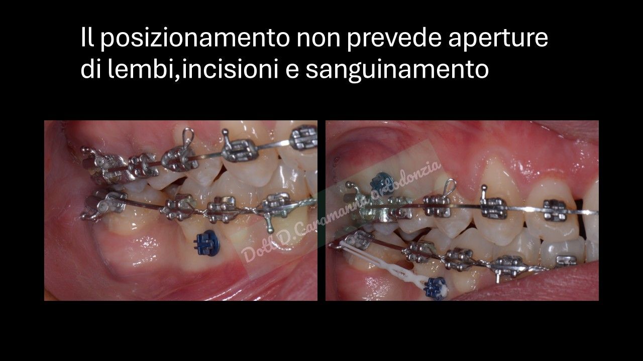 Daniele Caramanna-33