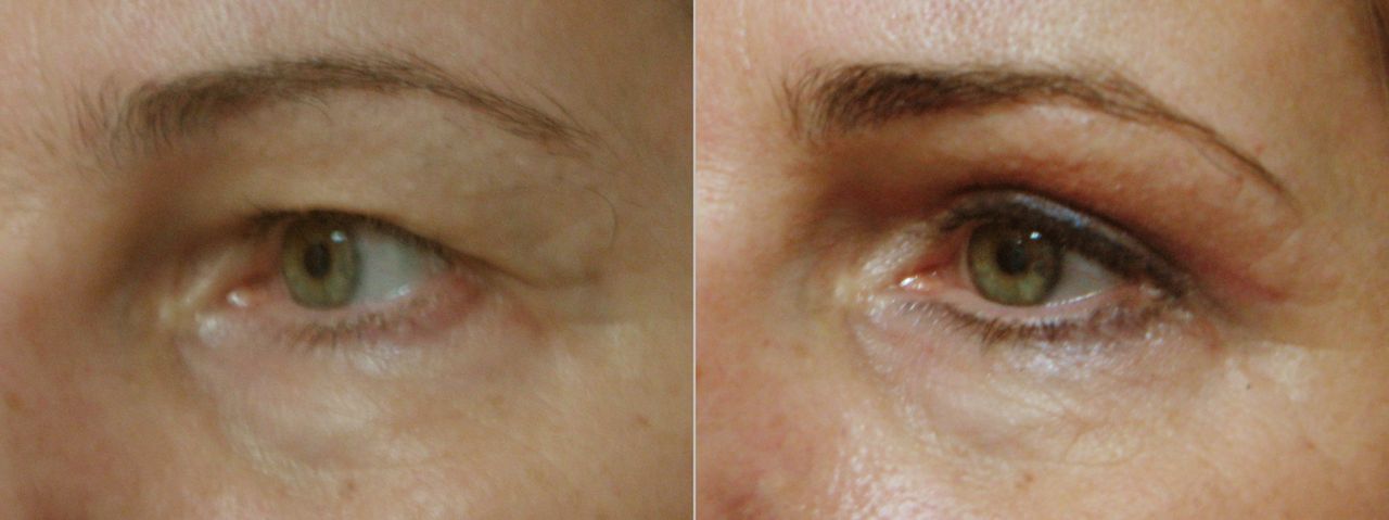 Małgorzata Keller-Skomska-3