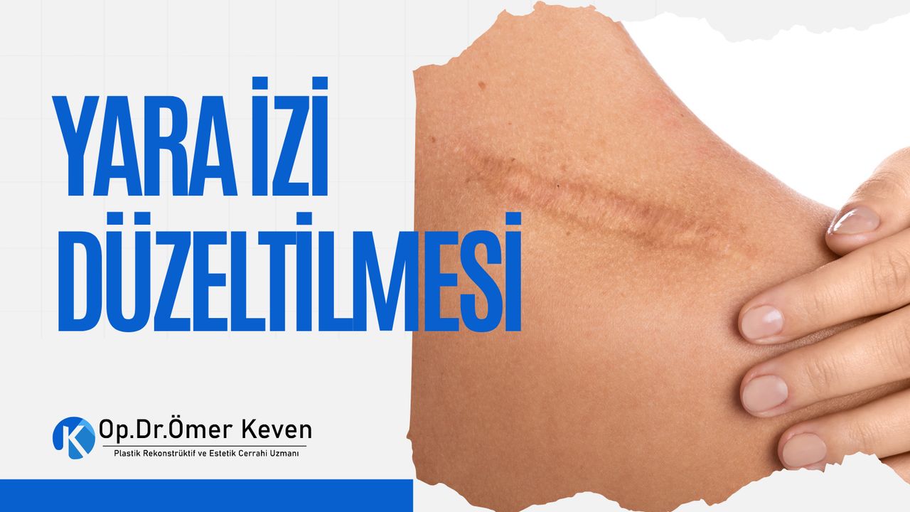 Ömer Keven-19