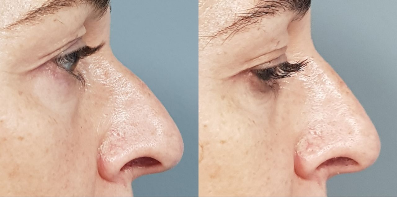 Rosalba Herrero Zerpa-490