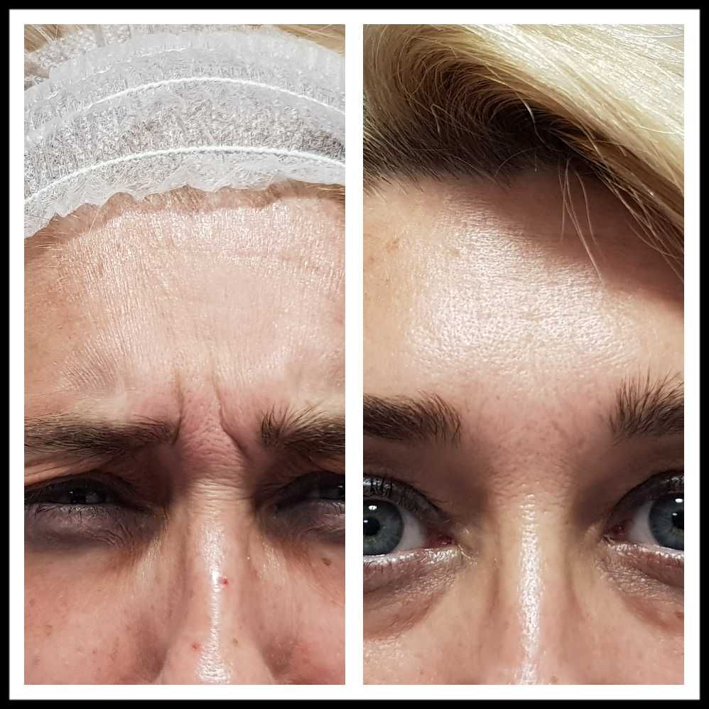 Rosalba Herrero Zerpa-380