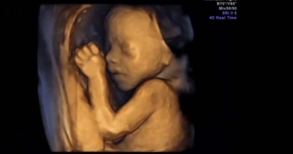 Izabela Macinkiewicz-12