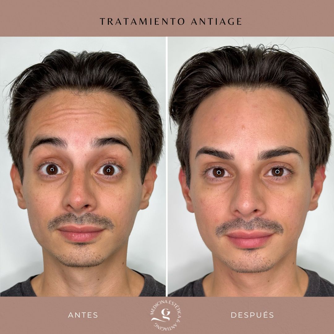 ​Giovanni Giorgianni-3