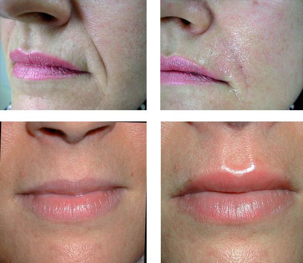 Maria Teresa Cirò-5