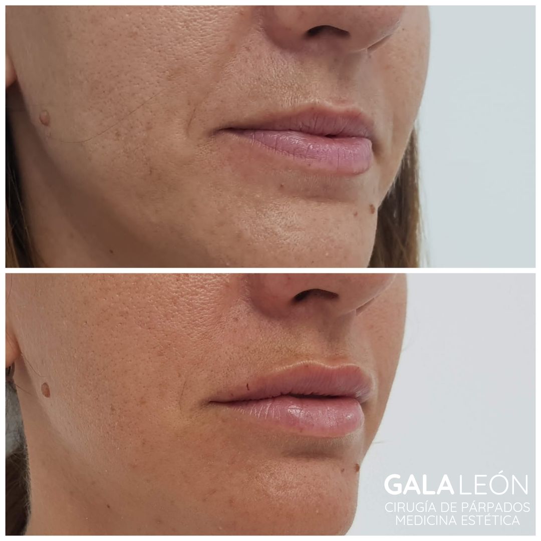 Gala P. Leon Salvatierra-7