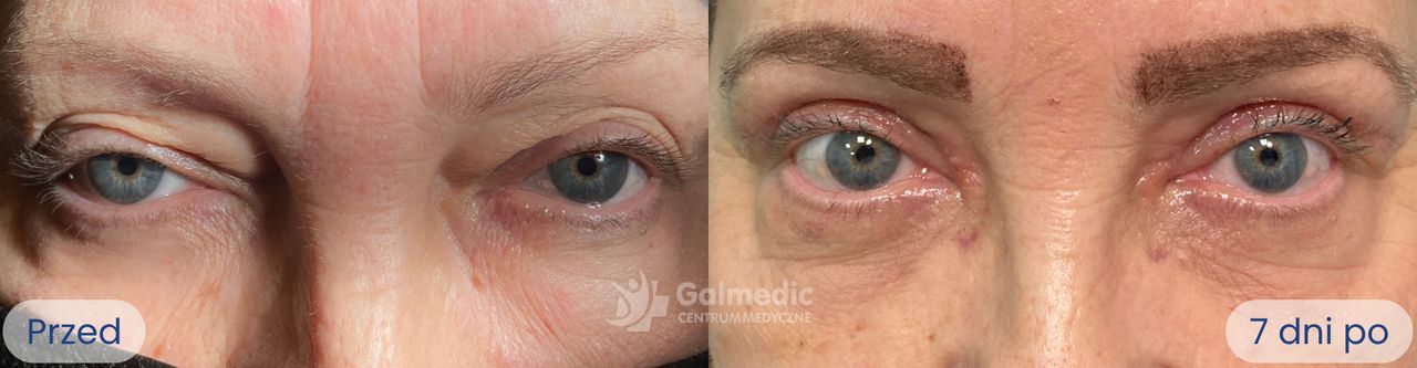 Jakub Staniszewski-2