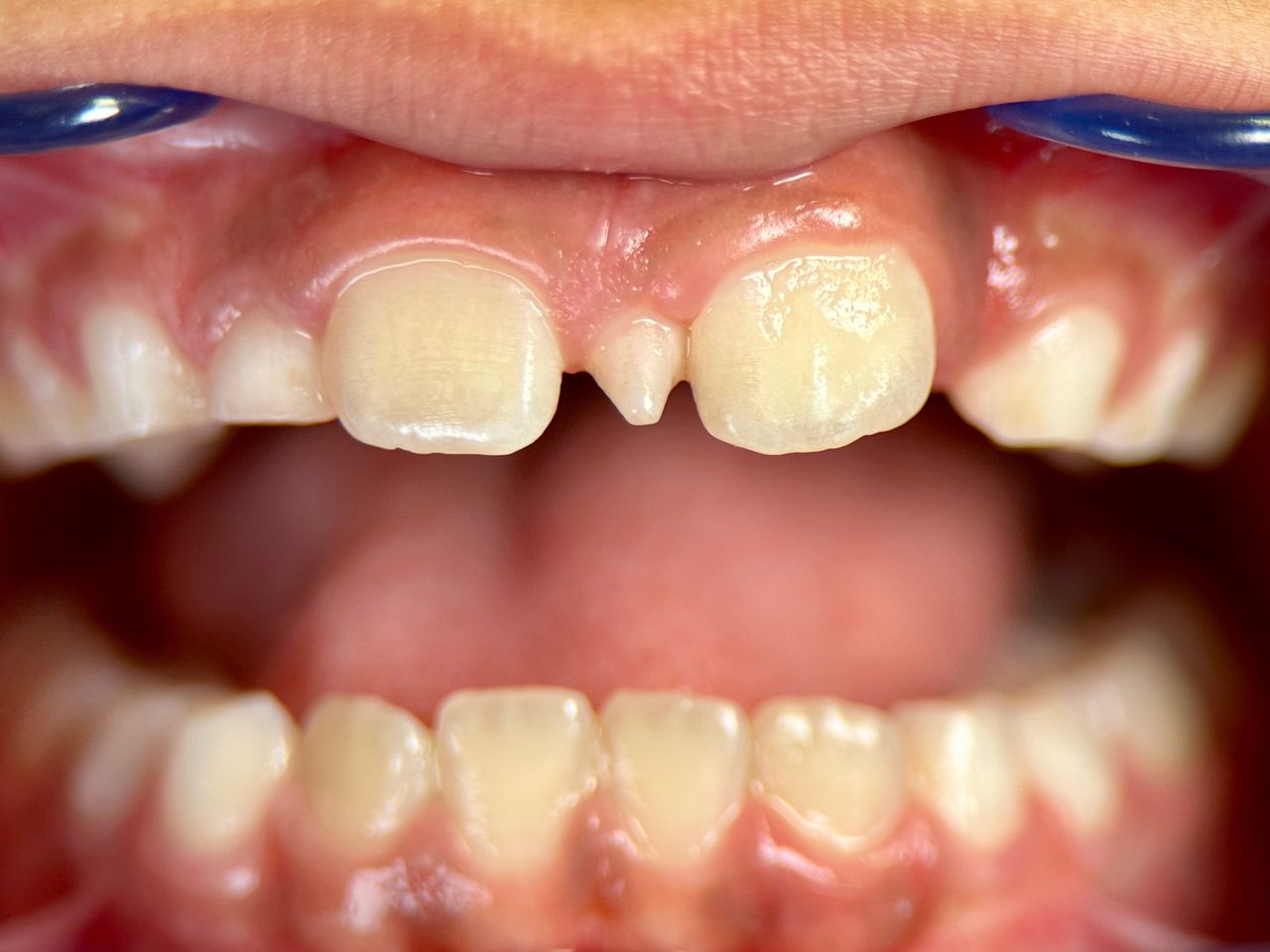 Alberto Bortoletti-1