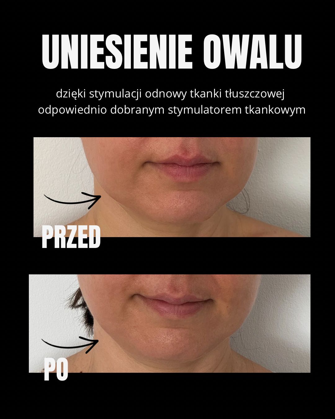 Izabela Skórka-0