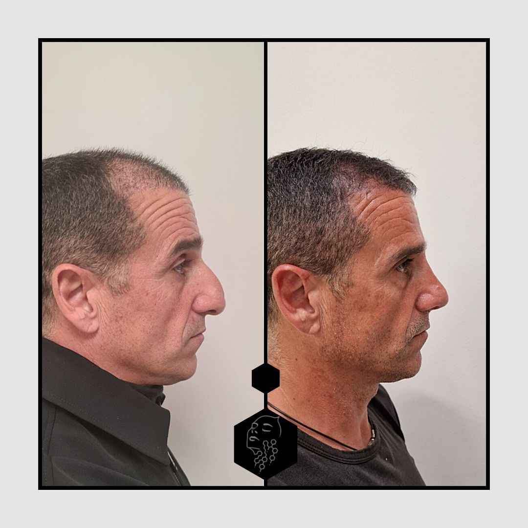 Fernando Molina Méndez-2