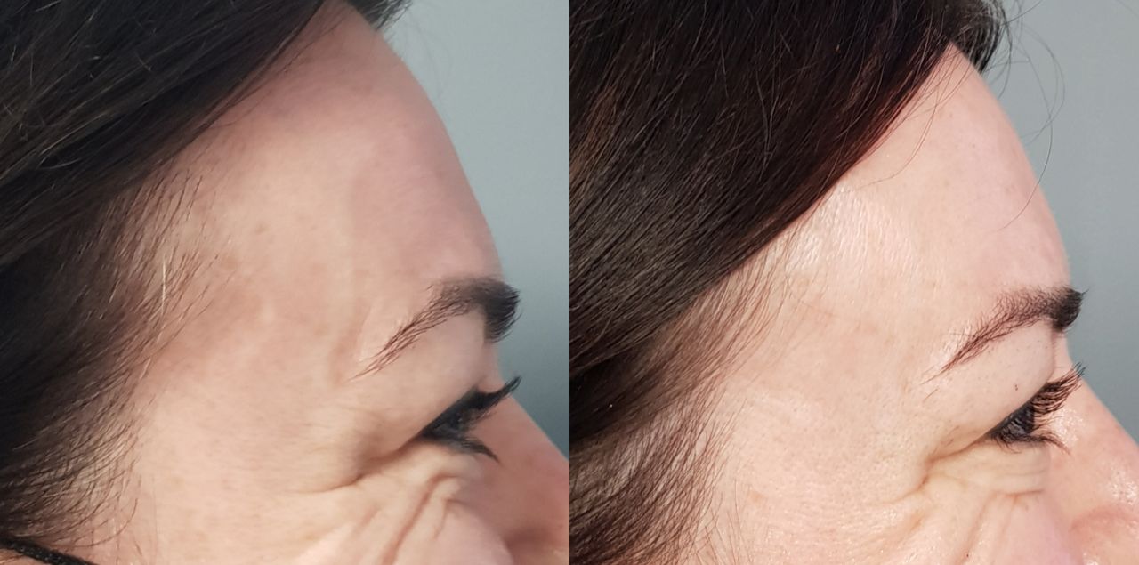 Rosalba Herrero Zerpa-120