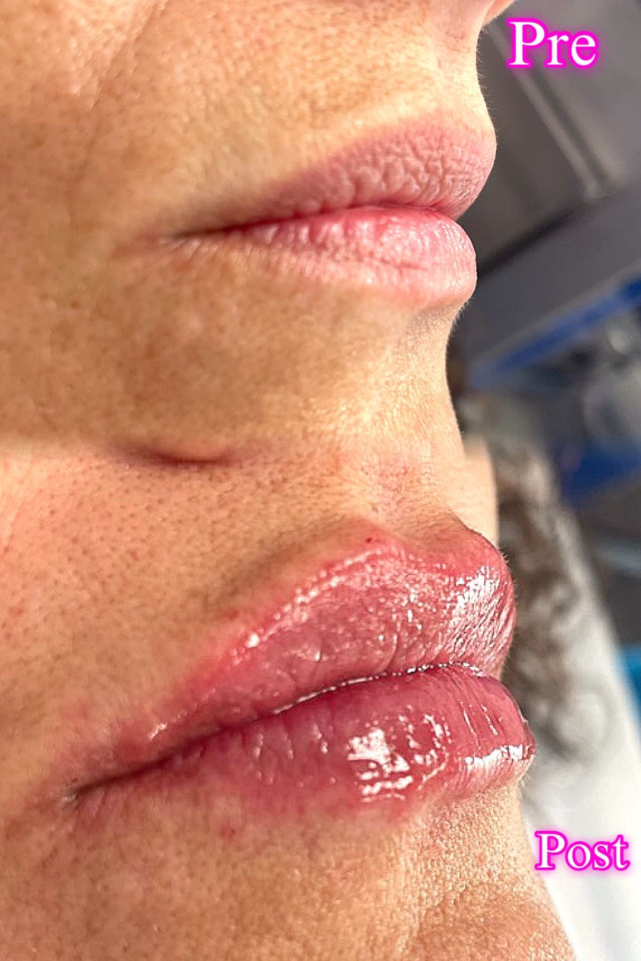 Vittoria Cassioli-83