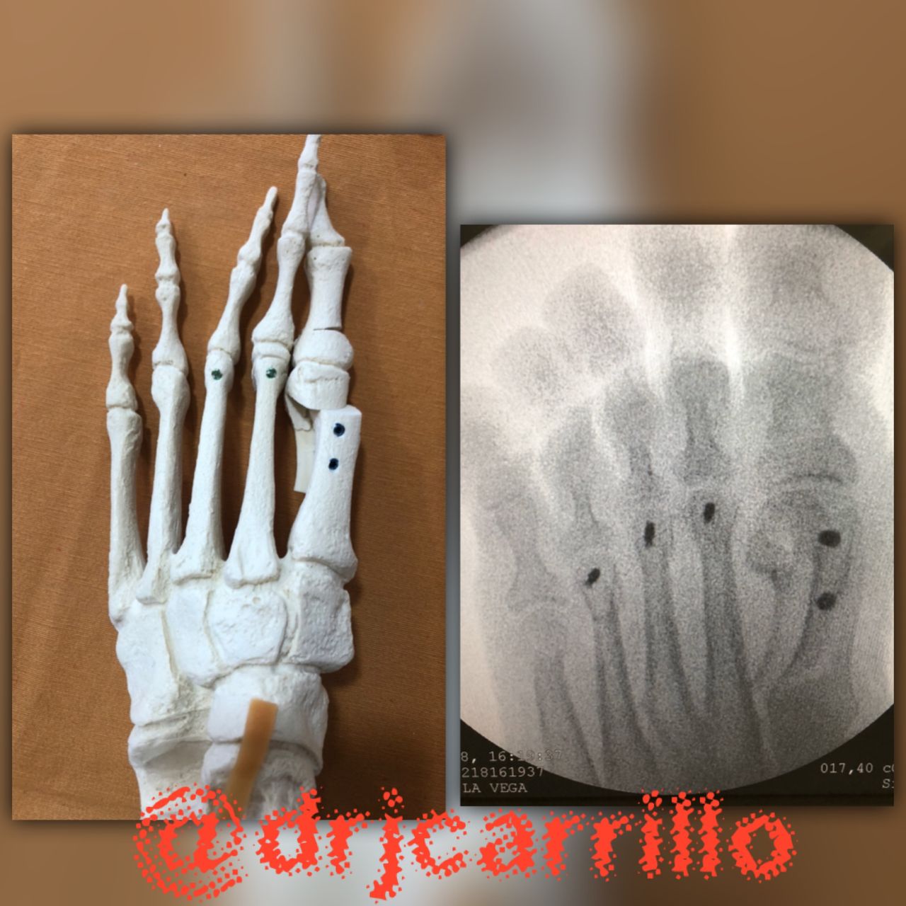 Fco Javier Carrillo Piñero-6