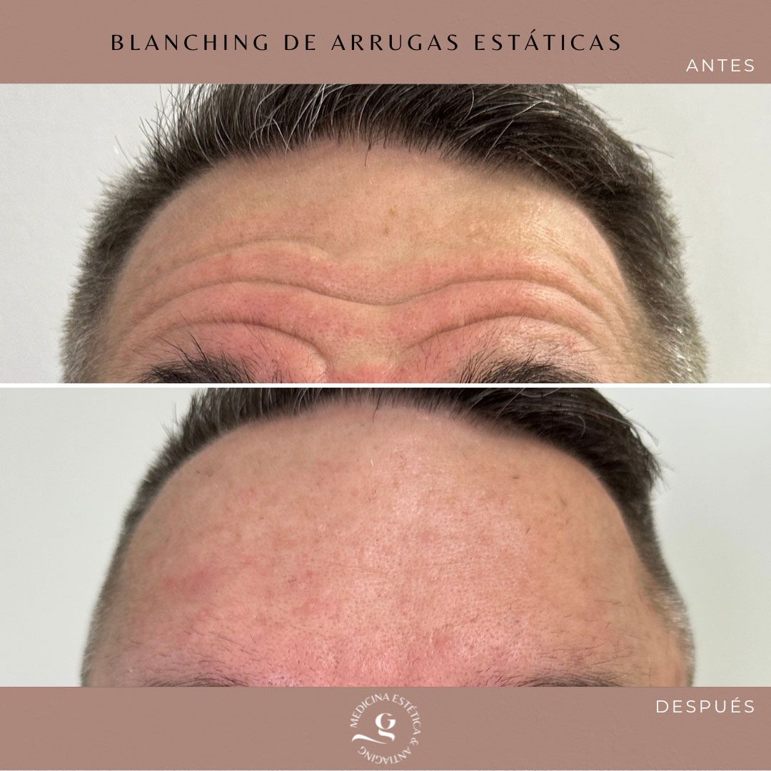 ​Giovanni Giorgianni-22