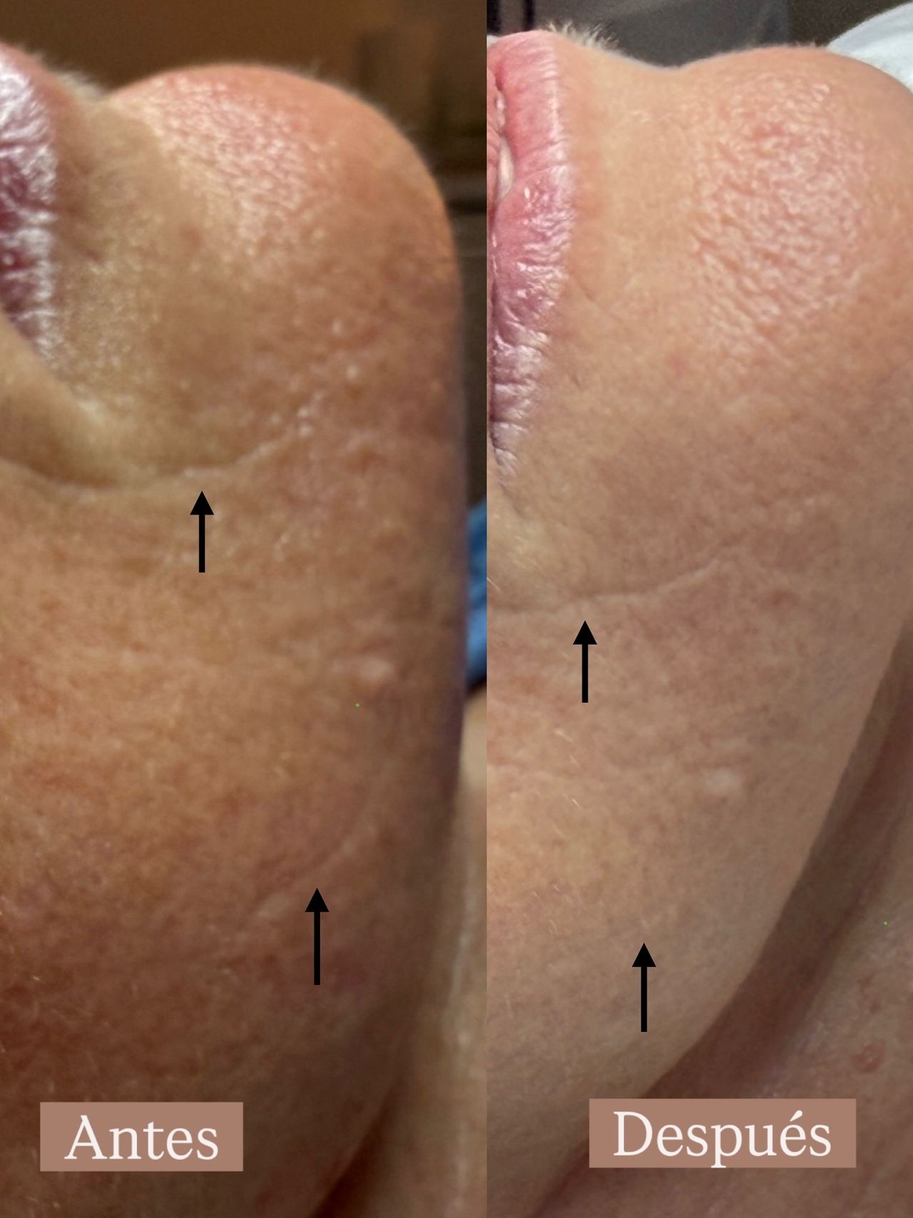 Àngels Nicolau Mesquida-2