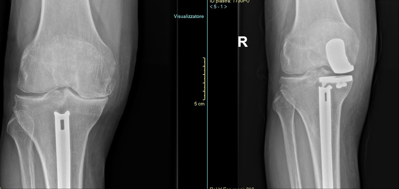 Luca Diego Serrao-11