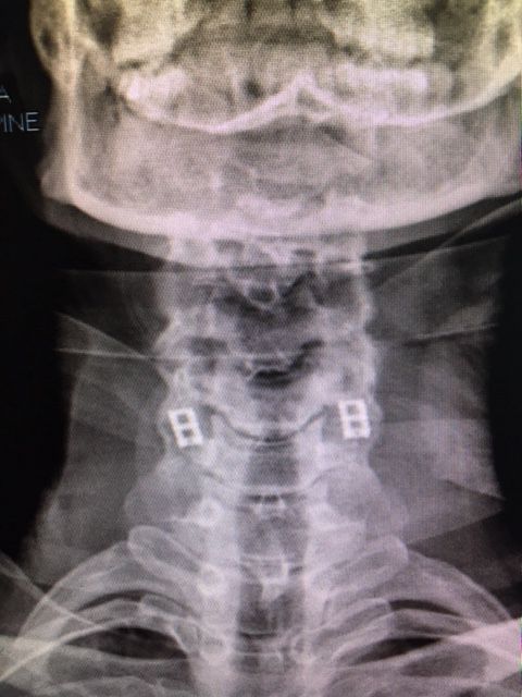 Massimo Brandolin-15