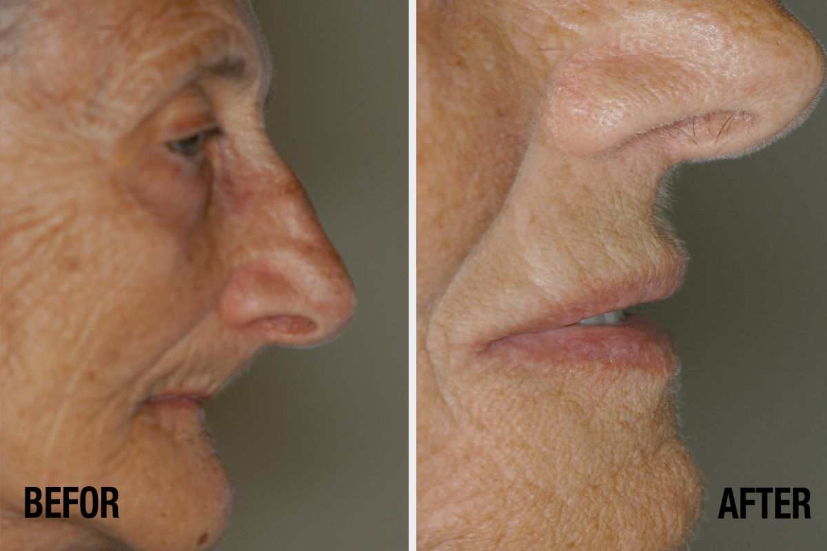 Alessandro Palumbo-37