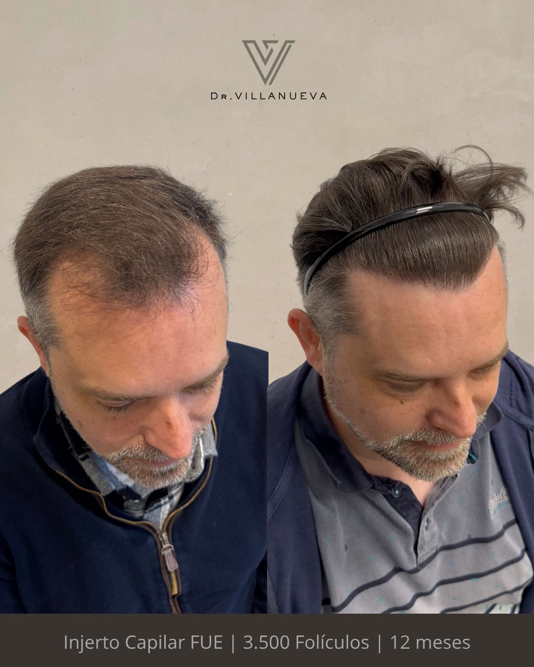 Alfredo Villanueva-6