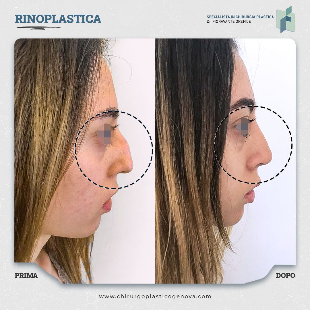 Fioravante Orefice-16